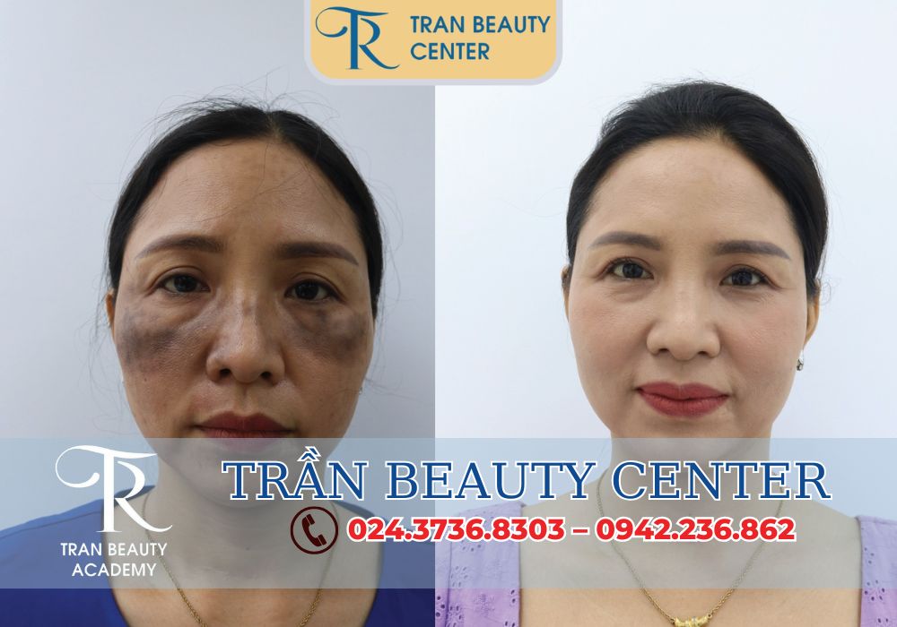 Dịch vụ nổi bật tại Trần Beauty Center không chỉ mang đến những giải pháp làm đẹp hiệu quả mà còn chú trọng đến an toàn và sức khỏe của khách hàng.