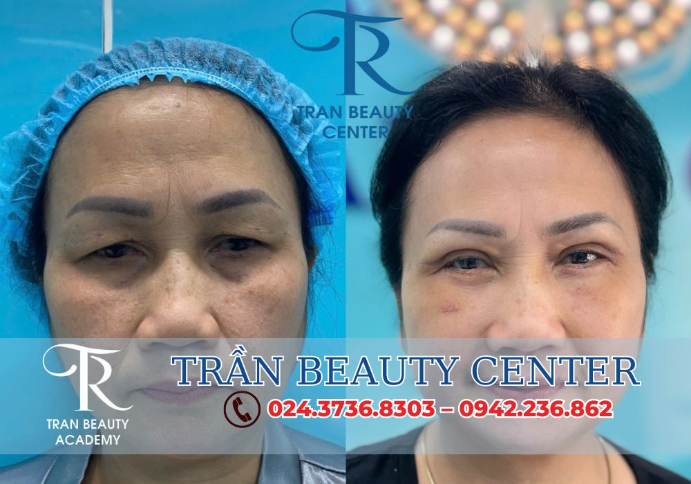 Đến với TRẦN BEAUTY CENTER, bạn sẽ cảm nhận được sự chuyên nghiệp và chu đáo trong từng dịch vụ.